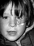 Boy With  Band-Aid